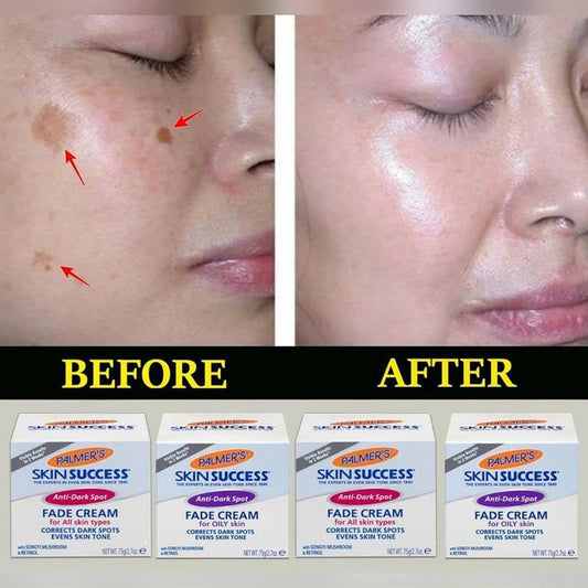 Palmer's Skin Success Fade Cream Anti-Dark Spot 75g
