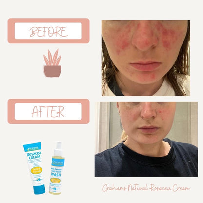 GRAHAMS Natural Anti-Redness Facial Wash 125ml