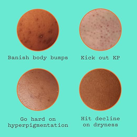 Frank Body Glycolic Body Scrub | Vegan, Cruelty Free, Exfoliating AHA Niacinamide