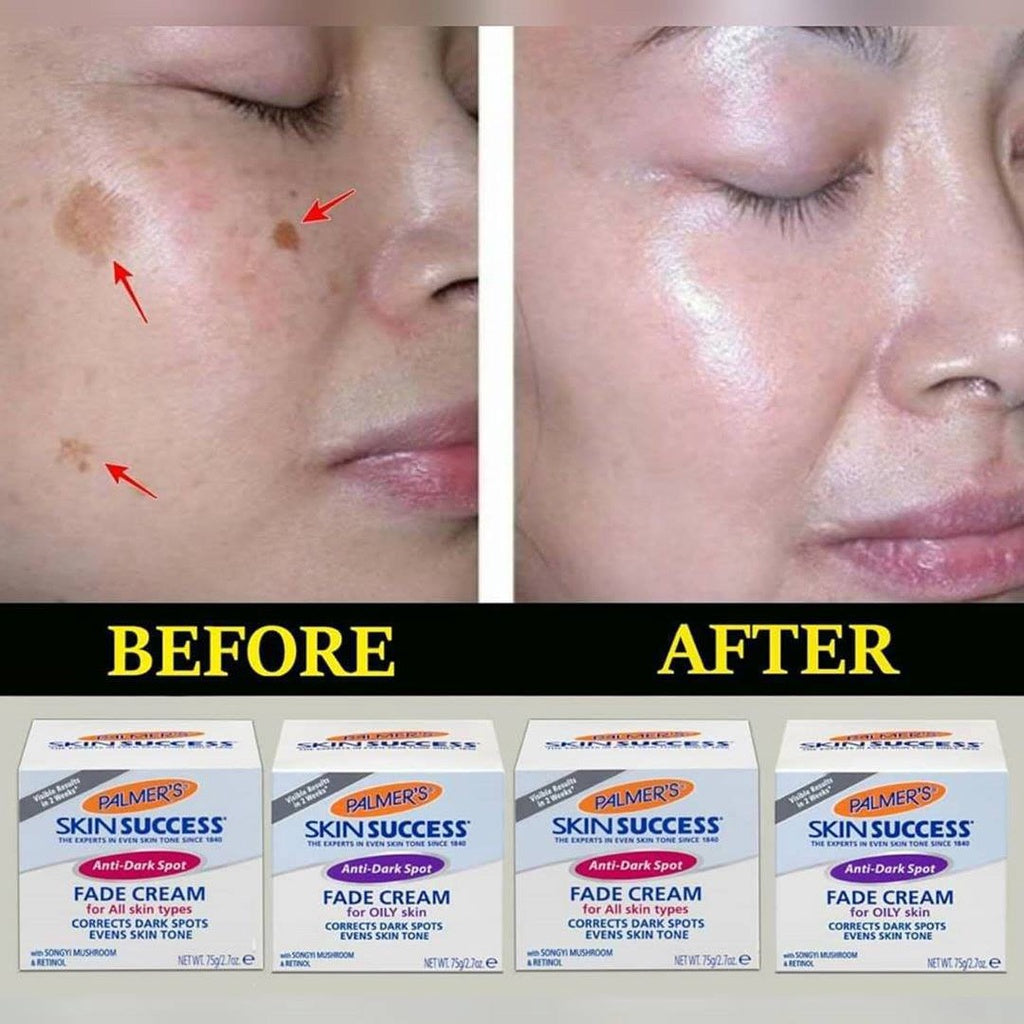 Palmer's Skin Success Fade Cream Anti-Dark Spot 75g